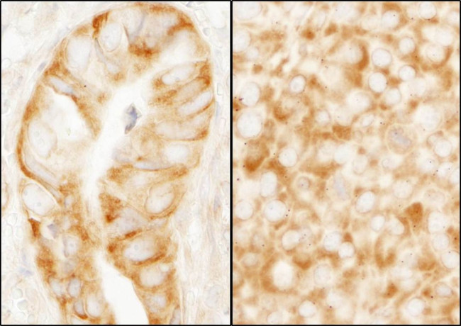 rpL7a/SURF3 Antibody in Immunohistochemistry (IHC)