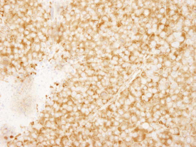 rpL7a/SURF3 Antibody in Immunohistochemistry (IHC)