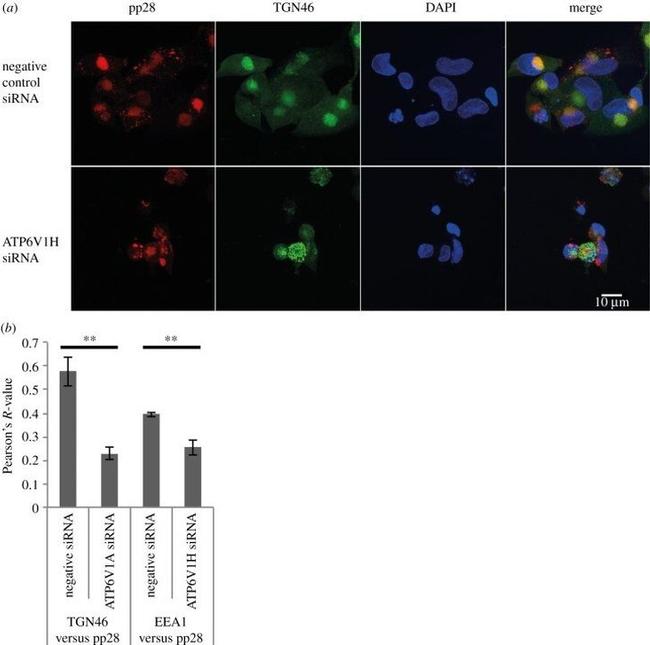 TGN46 Antibody in Immunocytochemistry (ICC/IF)