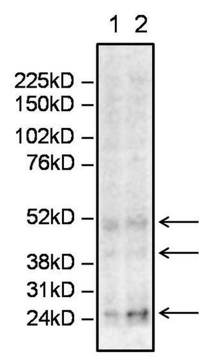 Sialosyl-Tn Antigen Antibody in Western Blot (WB)