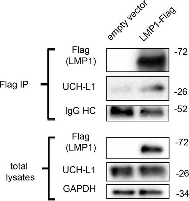 PGP9.5 Antibody in Western Blot (WB)