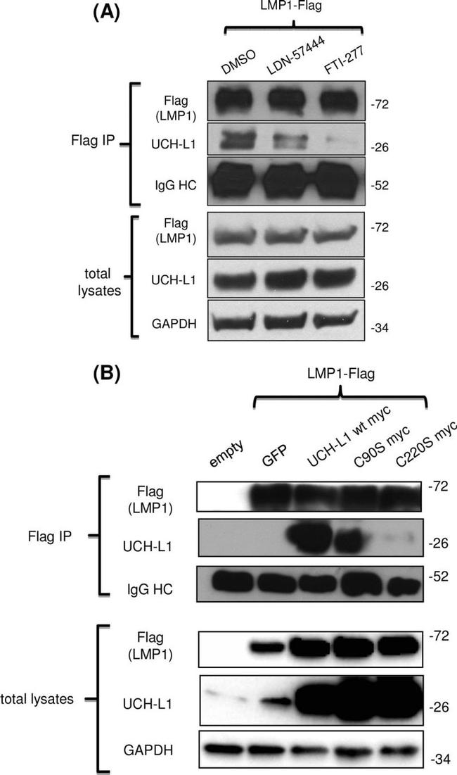 PGP9.5 Antibody in Western Blot (WB)