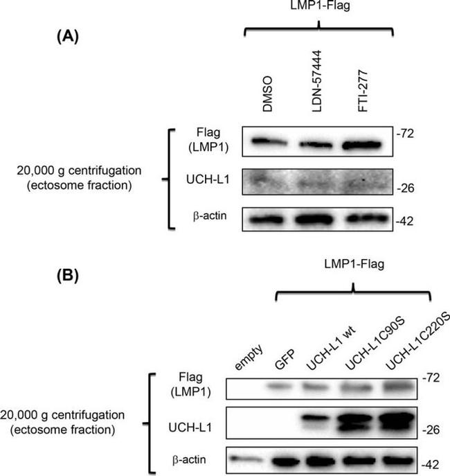 PGP9.5 Antibody in Western Blot (WB)