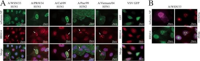 Nucleolin Antibody in Immunocytochemistry (ICC/IF)