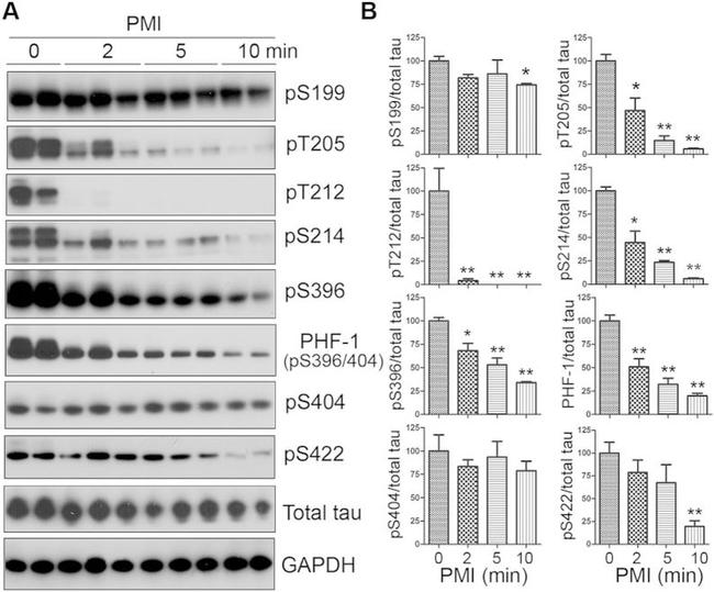 Phospho-Tau (Ser396) Antibody in Western Blot (WB)