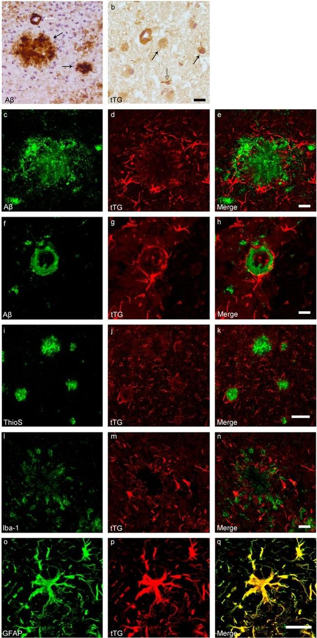 beta Amyloid Antibody in Immunohistochemistry (Frozen) (IHC (F))