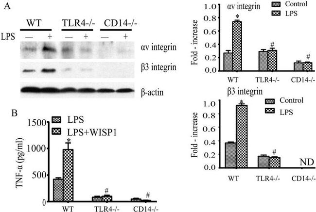 CD61 (Integrin beta 3) Antibody in Western Blot (WB)