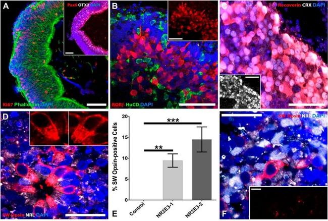 HuC/HuD Antibody in Immunocytochemistry (ICC/IF)