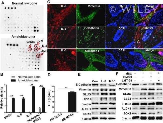 IL-6 Antibody in Immunohistochemistry (IHC)