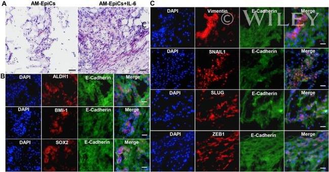 IL-6 Antibody in Immunocytochemistry (ICC/IF)