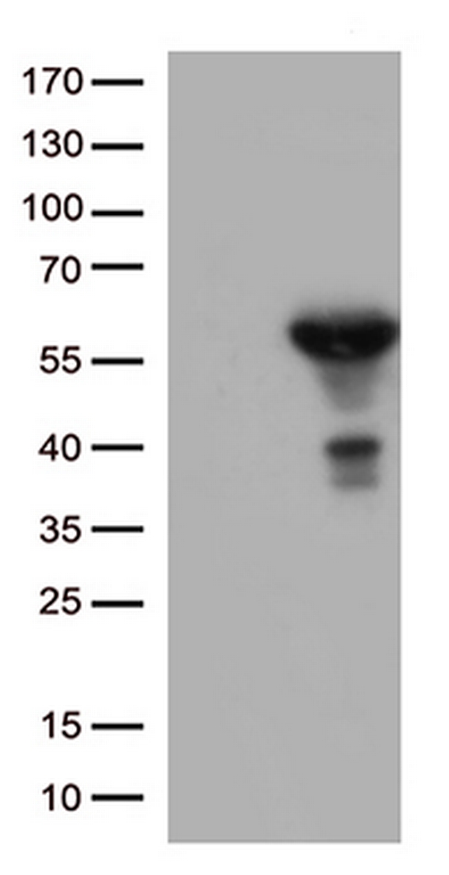 ALDH1A3 Antibody in Western Blot (WB)