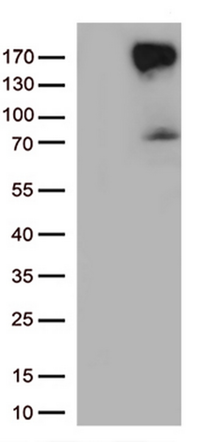 ERBB4 Antibody in Western Blot (WB)