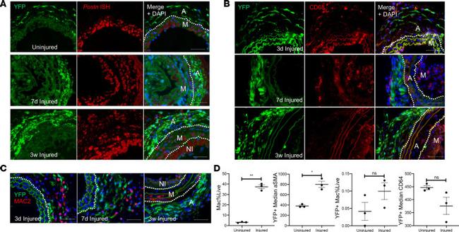 Alpha-Smooth Muscle Actin Antibody in Flow Cytometry (Flow)