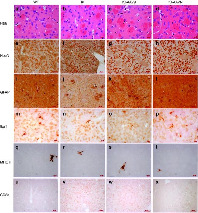 MHC Class II (I-A/I-E) Antibody in Immunohistochemistry (IHC)