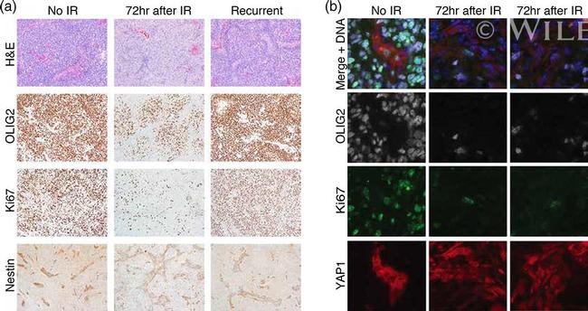 Ki-67 Antibody in Immunohistochemistry (IHC)