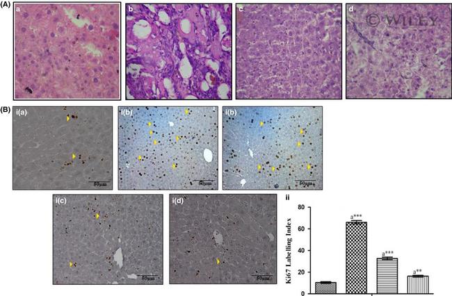 Ki-67 Antibody in Immunohistochemistry (IHC)