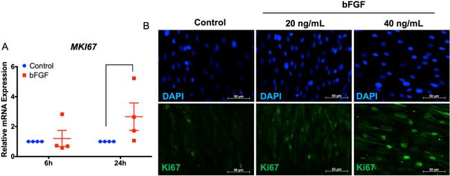 Ki-67 Antibody in Immunocytochemistry (ICC/IF)