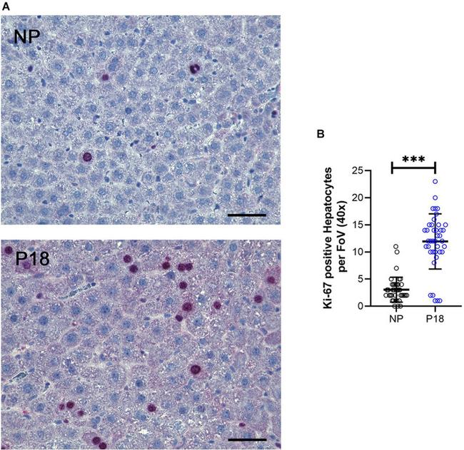 Ki-67 Antibody in Immunohistochemistry (IHC)