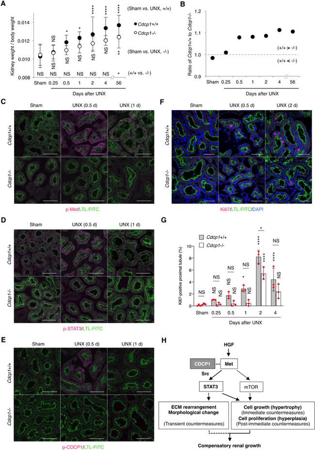 Ki-67 Antibody in Immunohistochemistry (IHC)