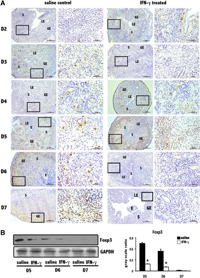 FOXP3 Antibody in Immunohistochemistry (IHC)