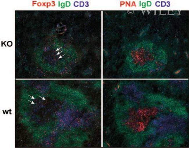 FOXP3 Antibody in Immunohistochemistry (IHC)