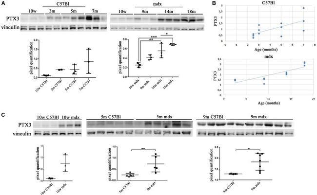 Vinculin Antibody in Western Blot (WB)