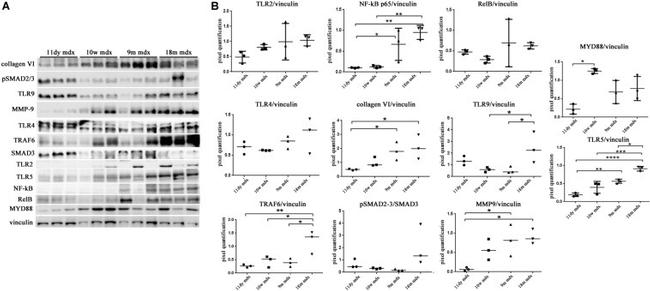 Vinculin Antibody in Western Blot (WB)