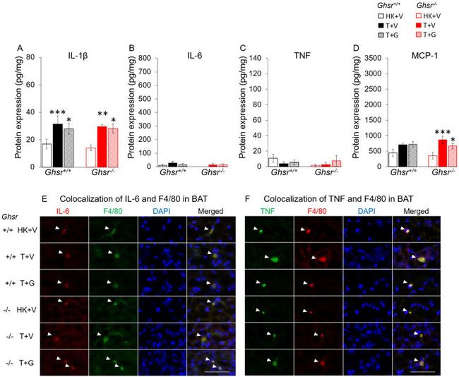 TNF alpha Antibody in Immunohistochemistry (IHC)