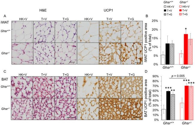 UCP1 Antibody in Immunohistochemistry (IHC)