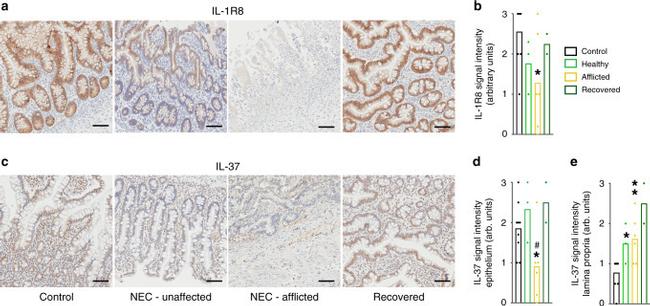 IL-37 Antibody in Immunohistochemistry (IHC)