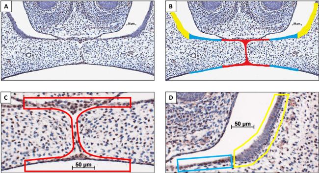 CXCL12 alpha (SDF-1 alpha) Antibody in Immunohistochemistry (IHC)