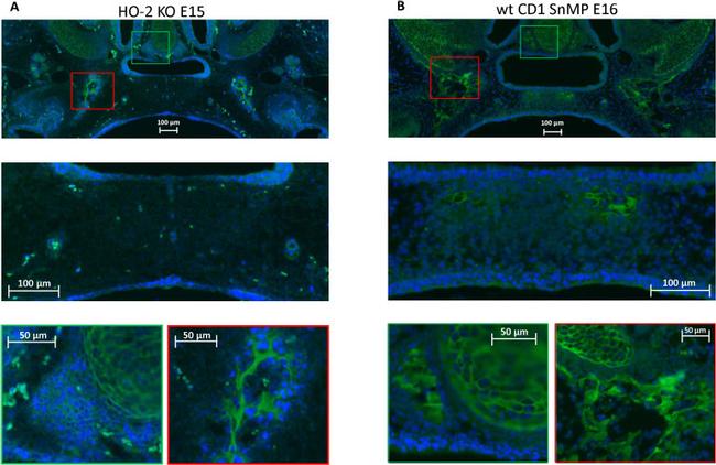 CXCR4 Antibody in Immunohistochemistry (IHC)