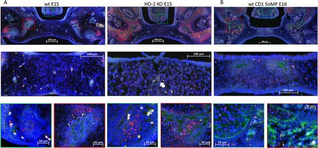 CXCR4 Antibody in Immunohistochemistry (IHC)