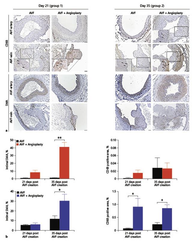 Alpha-Smooth Muscle Actin Antibody in Immunohistochemistry (IHC)