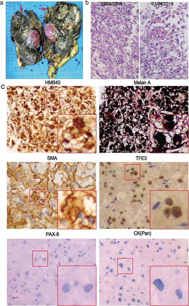 Alpha-Smooth Muscle Actin Antibody in Immunohistochemistry (IHC)