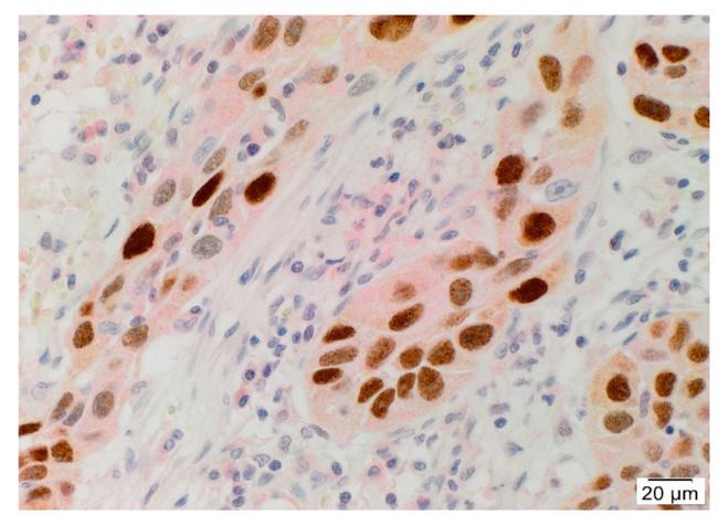 SOX2 Antibody in Immunohistochemistry (IHC)