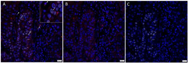 SOX2 Antibody in Immunohistochemistry (IHC)