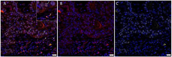 SOX2 Antibody in Immunohistochemistry (IHC)