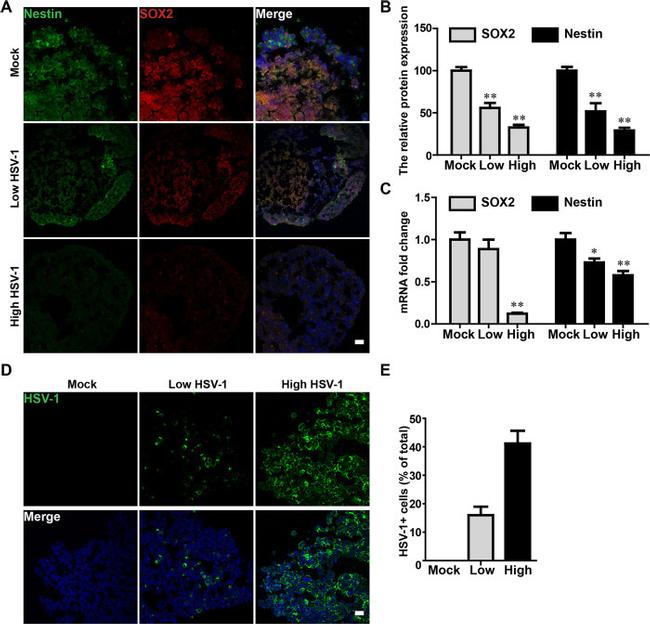 Nestin Antibody in Immunohistochemistry (IHC)