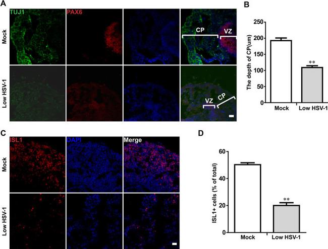 ISL1 Antibody in Immunohistochemistry (IHC)