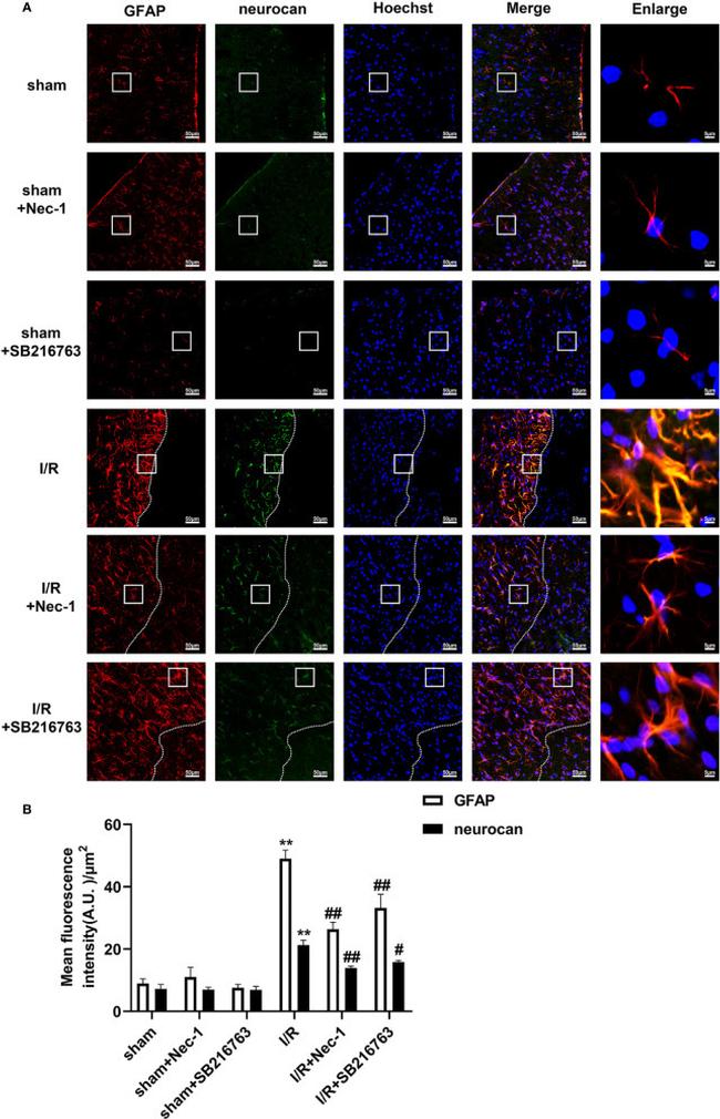 GFAP Antibody in Immunohistochemistry (IHC)