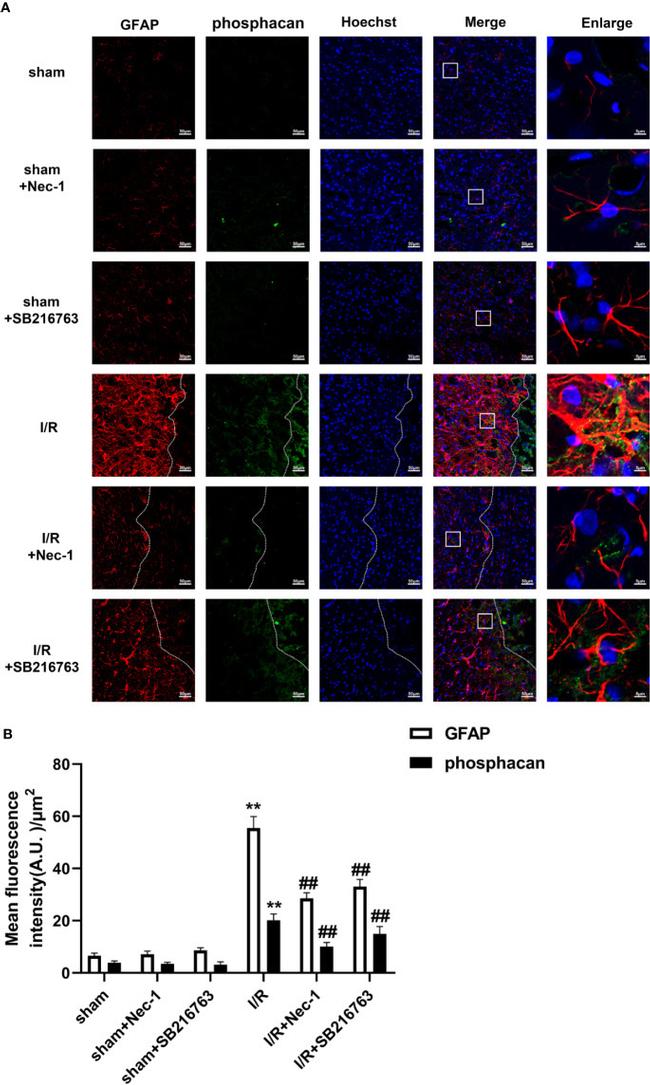 GFAP Antibody in Immunohistochemistry (IHC)