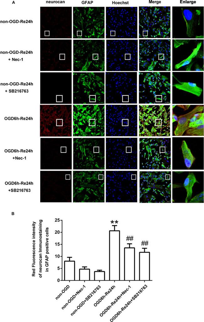 GFAP Antibody in Immunocytochemistry (ICC/IF)