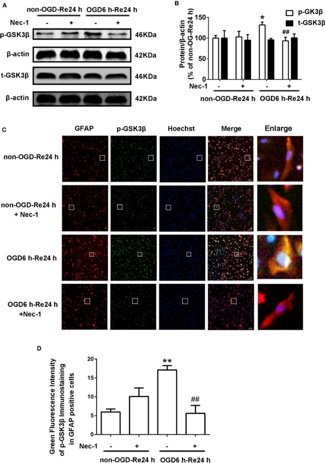 GFAP Antibody in Immunocytochemistry (ICC/IF)