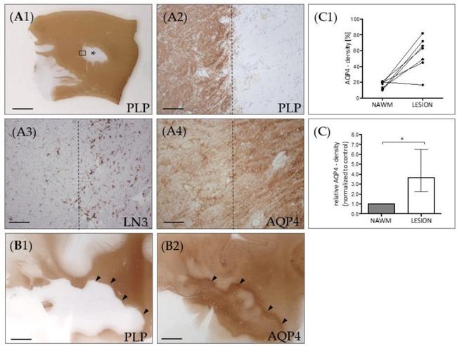 HLA-DR Antibody in Immunohistochemistry (IHC)