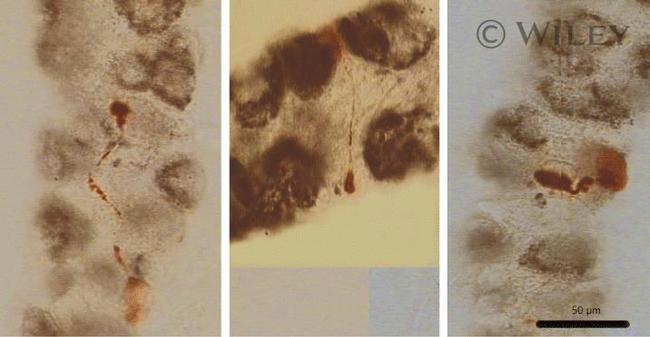 ATP4B Antibody in Immunohistochemistry (IHC)