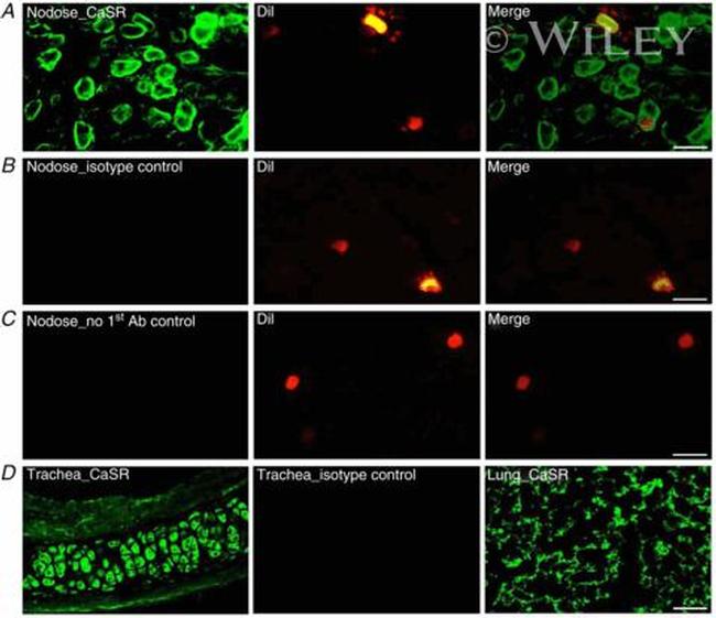 Calcium Sensing Receptor Antibody in Immunohistochemistry (IHC)