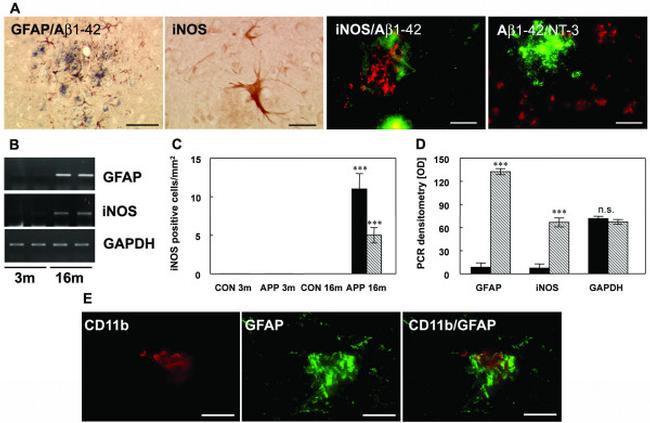 beta Amyloid (1-42) Antibody in Immunohistochemistry, Immunohistochemistry (Paraffin) (IHC, IHC (P))