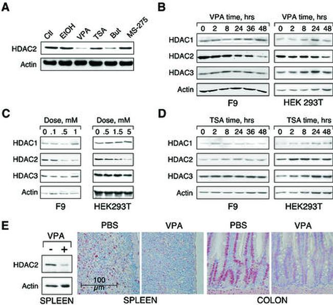 HDAC2 Antibody in Immunohistochemistry, Immunohistochemistry (Paraffin) (IHC, IHC (P))