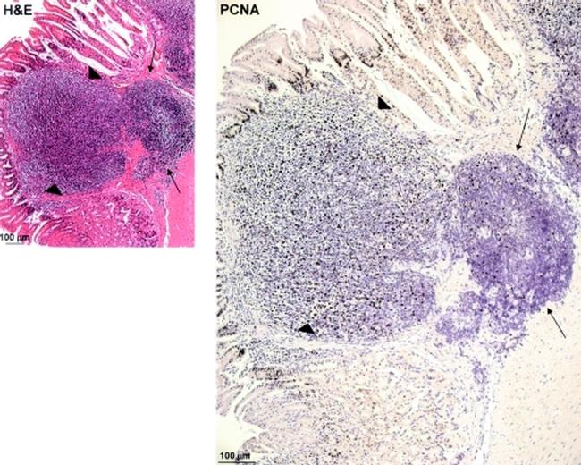 PCNA Antibody in Immunohistochemistry, Immunohistochemistry (Paraffin) (IHC, IHC (P))